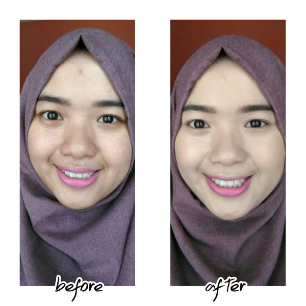 Beli 1 Gratis 1 - April Skin 2.0